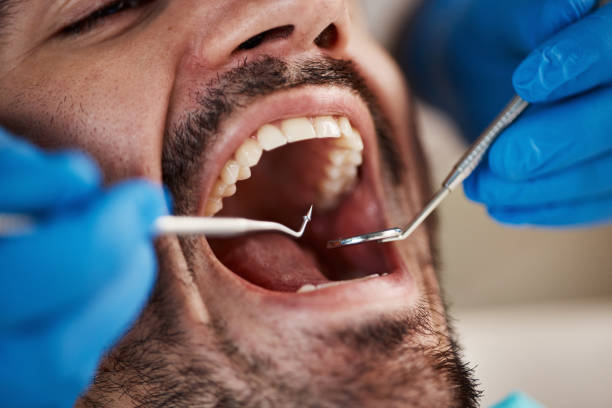 Best Broken Tooth Emergency  in Lake City, SC